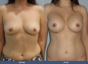 Almeida Ba B2c Front