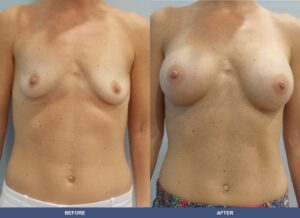 Barnhart Ba A2c Front