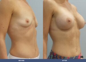 Barnhart Ba A2c Oblique