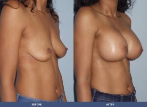 Brown Ba B2d Oblique