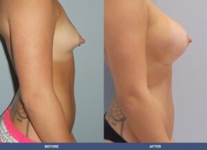 Casillas Ba A2c Side