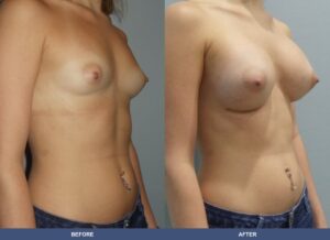 Cooney Ba A2c Oblique