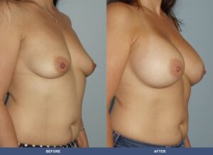 Delguidice Ba B2d Oblique