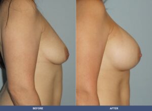 Delguidice Ba B2d Side