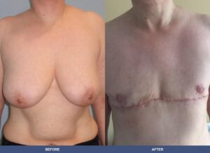 Dickson Ftm Front