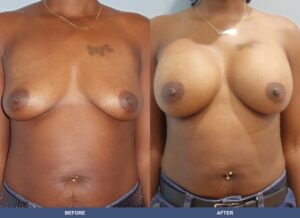 Francis Ba B2d Front