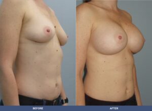 Fuller Ba B2d Oblique