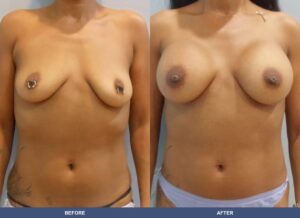 Henderson Ba B2d Front