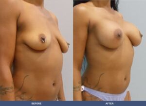 Henderson Ba B2d Oblique