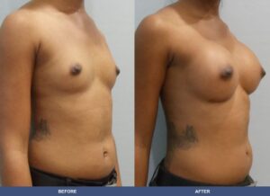 Hinds Ba A2b Oblique