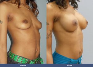 Holmes Ba B2c Oblique