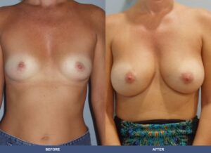 Holubeck Ba A2c Front