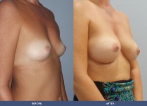 Holubeck Ba A2c Oblique