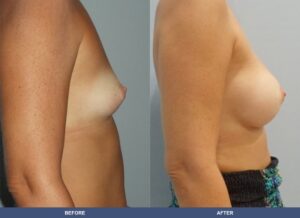 Holubeck Ba A2c Side