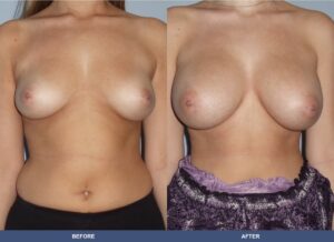 Hunsinger Ba B2d Front