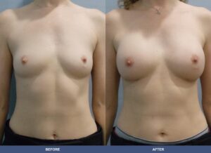 Jackson304 Ba A2b Front