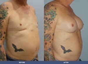 Kendall Bamtf Oblique