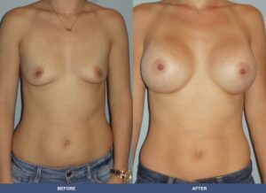 Machado Ba A2c Front