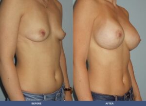 Machado Ba A2c Oblique