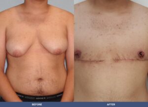 Marks Ftm Front