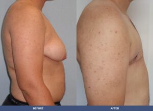 Marks Ftm Side