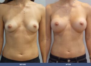 Marra400 Ba A2c Front