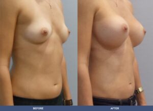 Marra400 Ba A2c Oblique