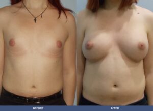 Martorell Tg Ba A2c Front