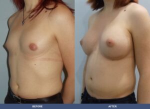 Martorell Tg Ba A2c Oblique