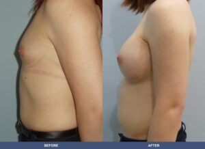 Martorell Tg Ba A2c Side 1