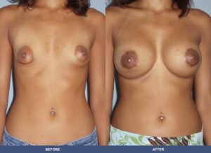 Mckenzie Ba A2c Front