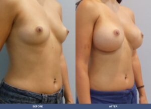 Medina Ba B2d Oblique