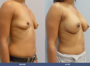 Njeri Ba B2c Oblique