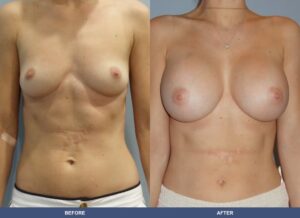 Paradis Ba B2c Front