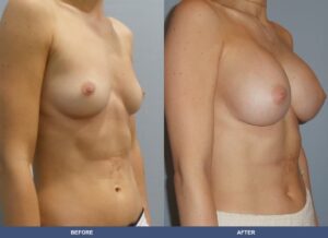 Paradis Ba B2c Oblique