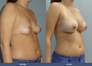 Parris Ba B2d Oblique