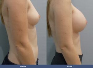 Rodriguez Hillary Ba C2d Side