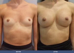 Stewart Ba A2c Front