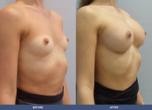 Stewart Ba A2c Oblique