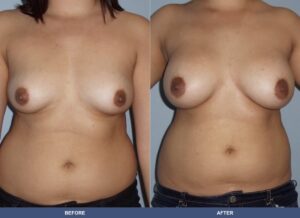 Valerio Ba B2c Front