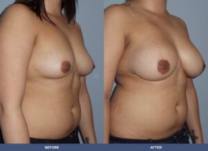 Valerio Ba B2c Oblique