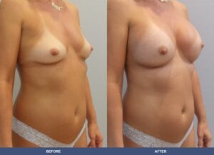 Varga Ba A2d Oblique