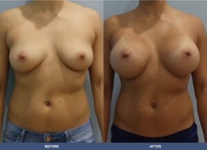 Wallach Ba B2d Front