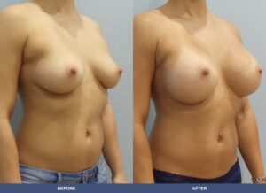 Wallach Ba B2d Oblique