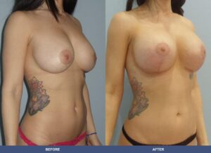 Weiss Bal Pexy Right Oblique