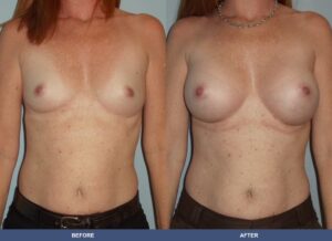 White B Ba A2c Front