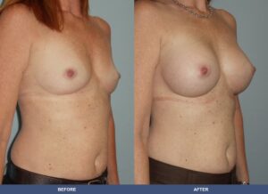 White B Ba A2c Oblique