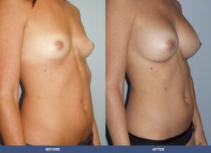 White339 Ba A2b Oblique