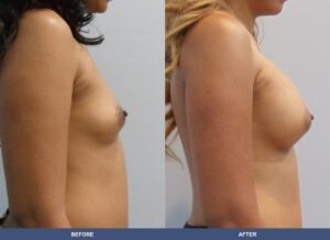 Williams Ba B2c Side