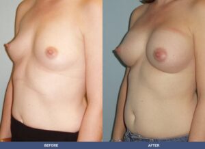 Wright Ba A2b Oblique